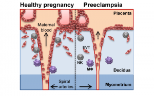 spiral-arteries-and-trophoblast-invasion-in-healthy-and-preeclamptic-pregnancy