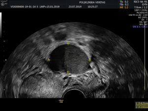 image_1