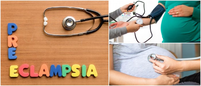 la-preeclampsia